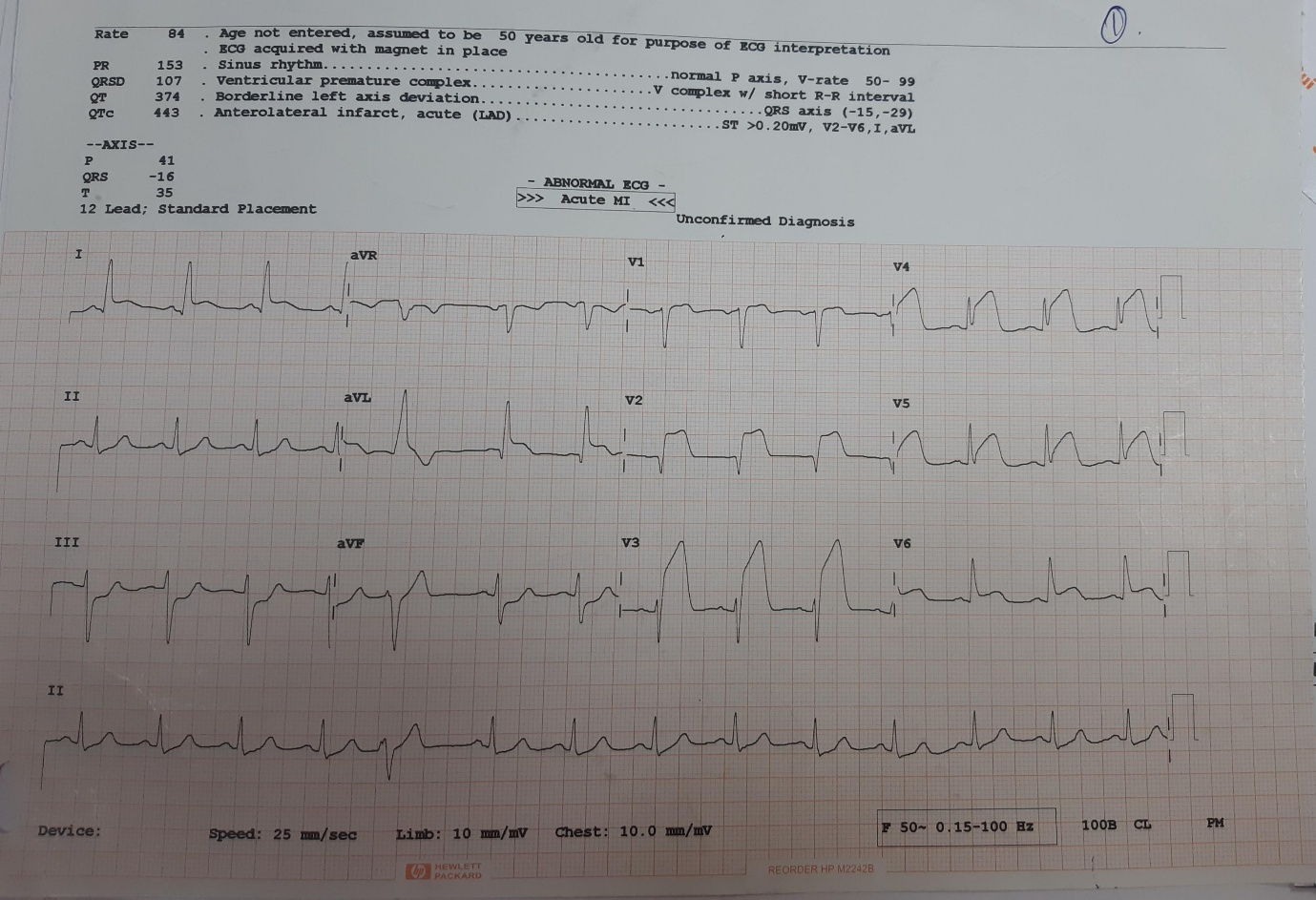 Arrival-ECG
