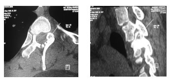 Minimally-invasive-surgery-2