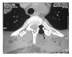 Minimally-invasive-surgery-3