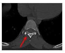 Minimally-invasive-surgery-5