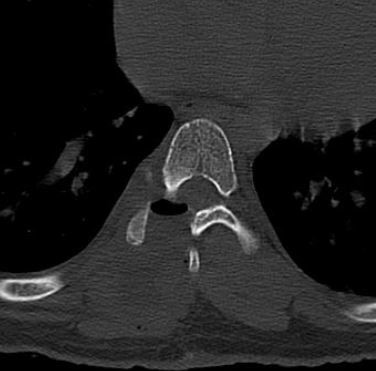 Minimally-invasive-surgery-8