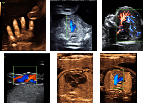 Foetal-Medicine-2