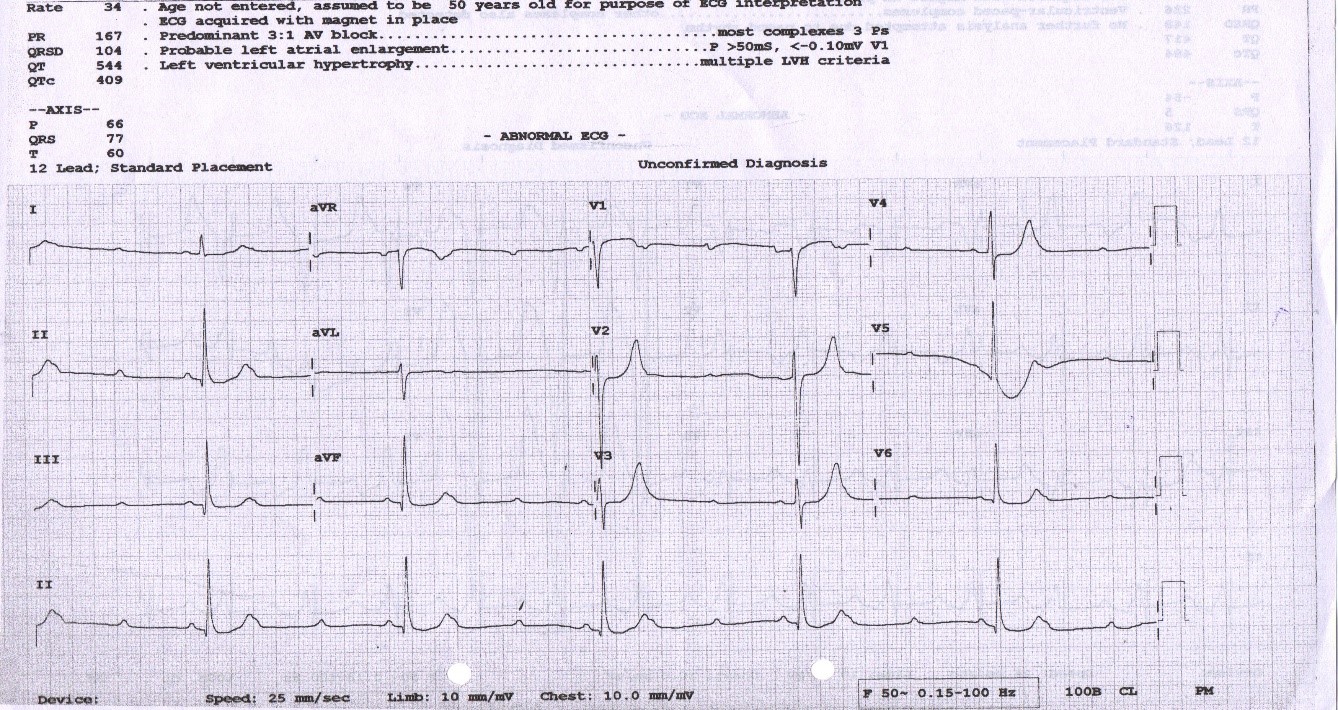 My-Father-s-Heart-Block-1