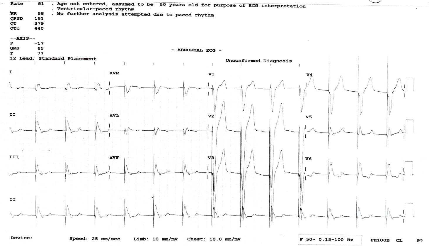 My-Father-s-Heart-Block-2