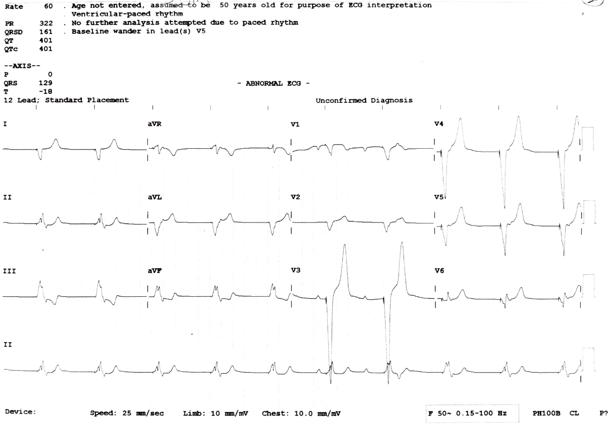 My-Father-s-Heart-Block-3