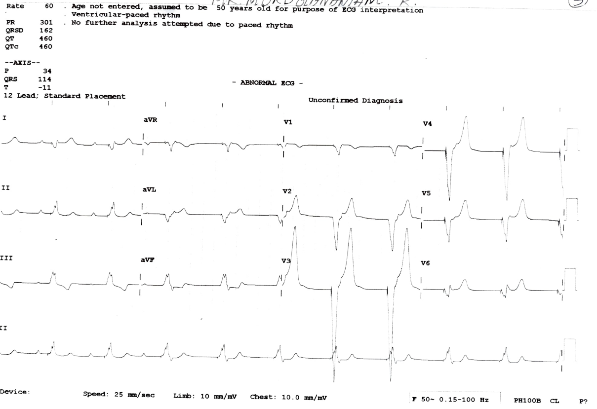 My-Father-s-Heart-Block-4