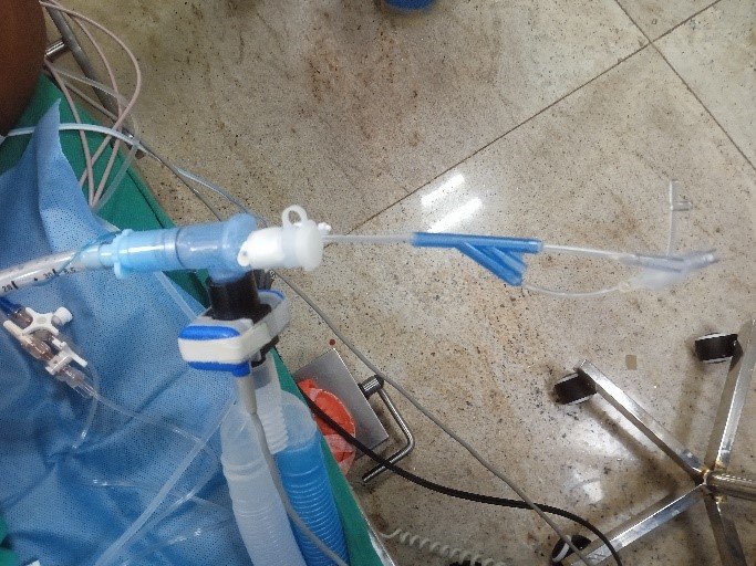 Pain-free-CABG-2