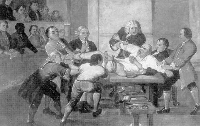 The-painful-story-behind-modern-anaesthesia-1
