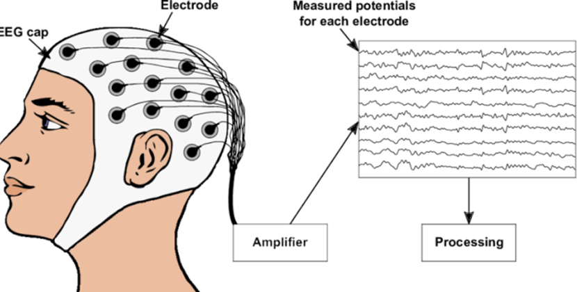 Total-intravenous-anaesthesia-3