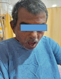 Anaesthetic-management-2