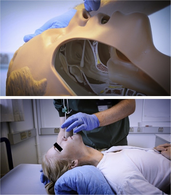 Lignocaine-nasal-spray-1