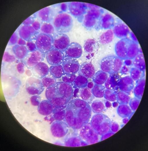 atlas-of-haematology-and-hematooncology-1