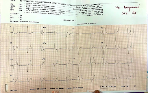 Hyperkalemia-3