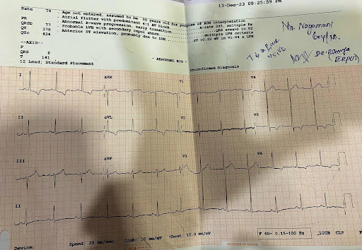 Hyperkalemia-4