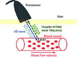 Basics-of-Doppler-imaging-principles