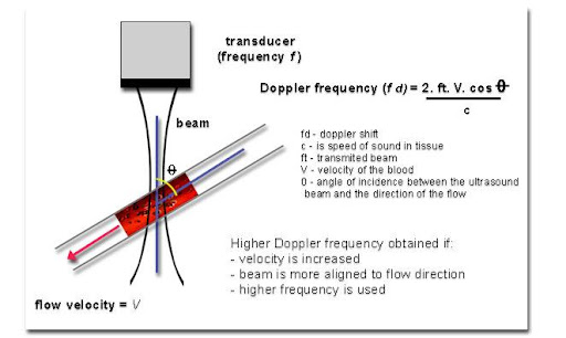 Doppler-machine