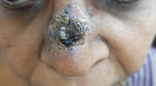 Pretreatment-clinical-photograph