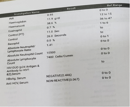 Internuclear-Ophthalmoparesis3