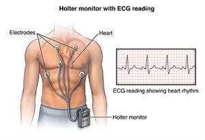 Small-heart-recorder