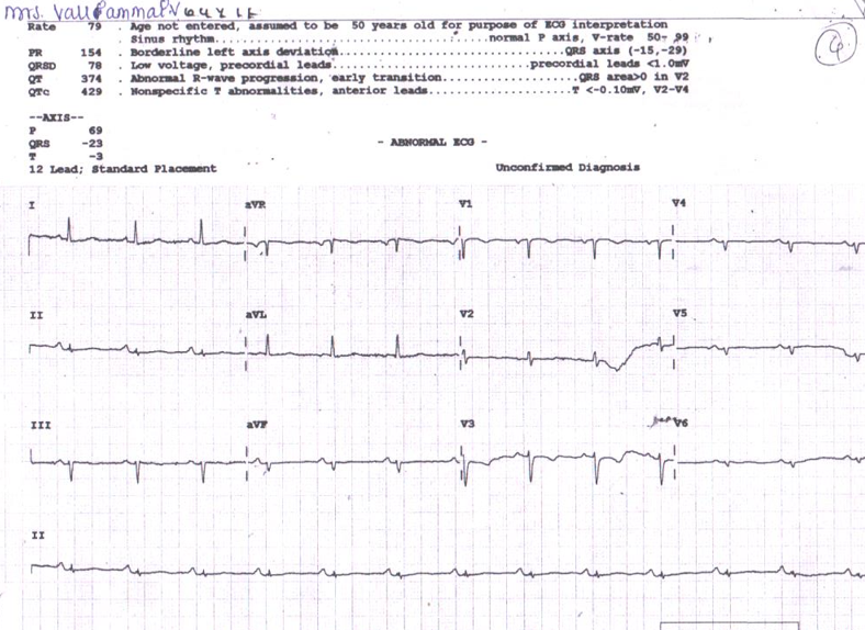 several-sinus-node-4