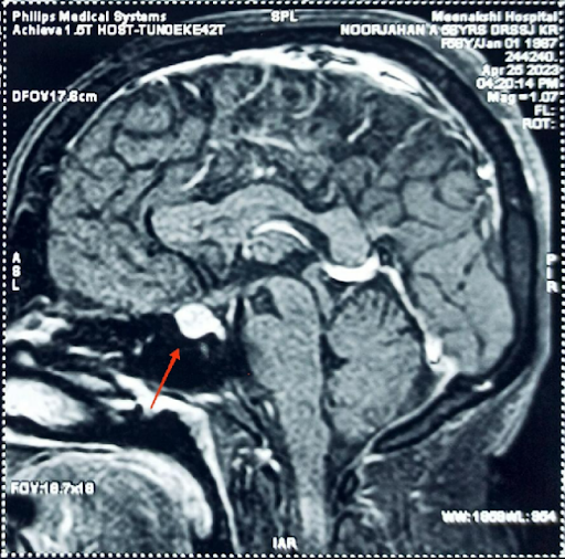 MRI-brain-1