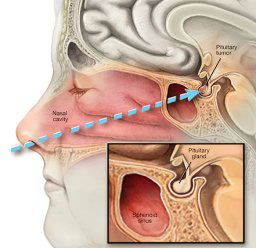 MRI-brain-2