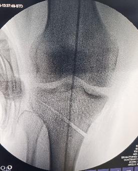 Radiograph-3