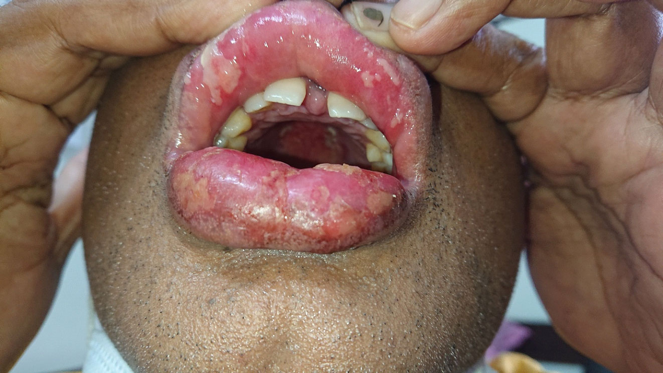 vol2-image12