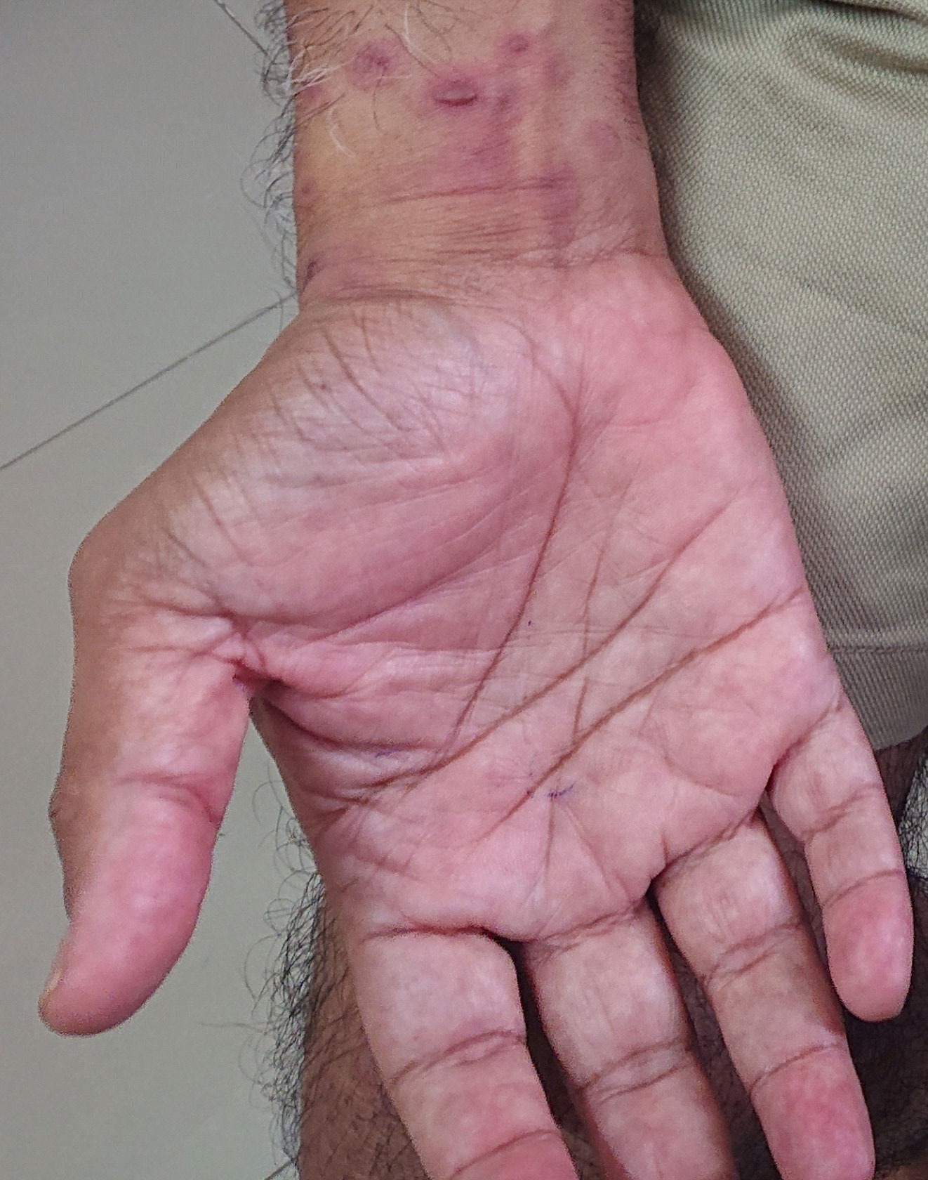 vol2-image13