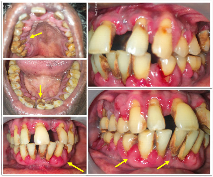 vol2-image6
