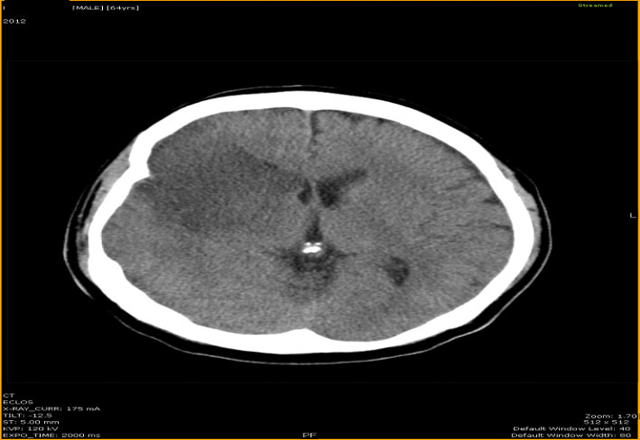 associlate-covid-19-image1