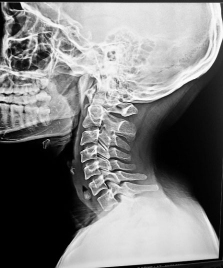 diagnostic-image4