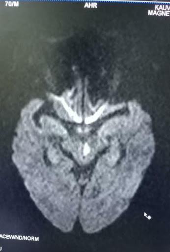 Diagnostic-Video-2