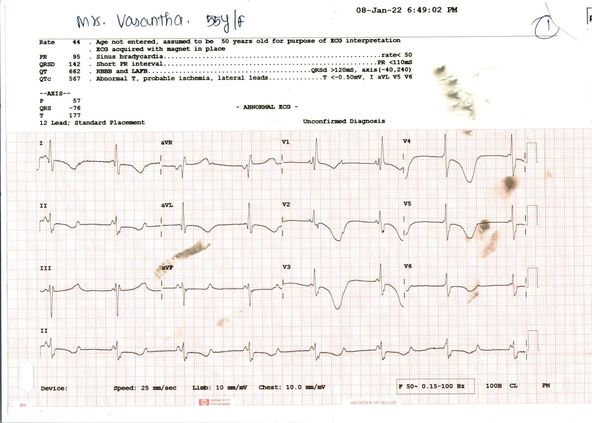 ECG-1
