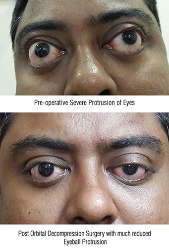 oculoplasty