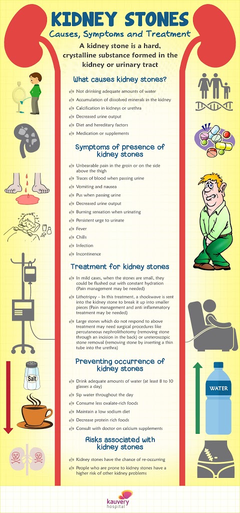 info-graphic-01