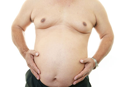 gynaecomastia