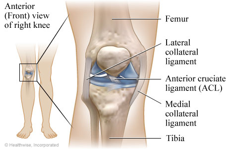 ligament-tear
