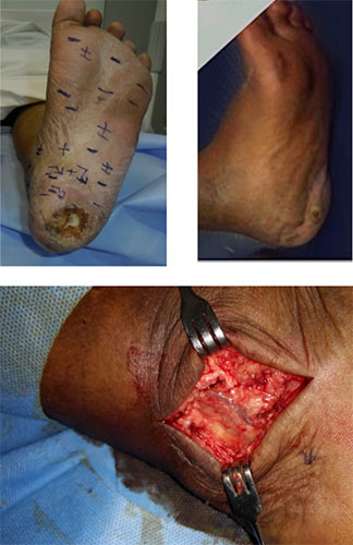 Reconstructive surgery in Chennai, Trichy, Salem,Tirunelveli, India plastic-surgery-2