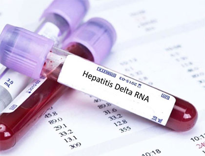hepatitis-d