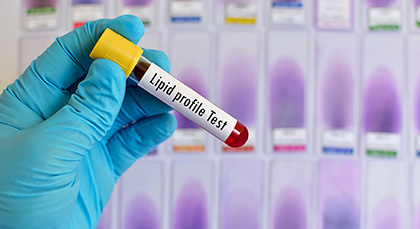 lipid