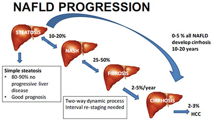 nafld