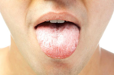 tongue