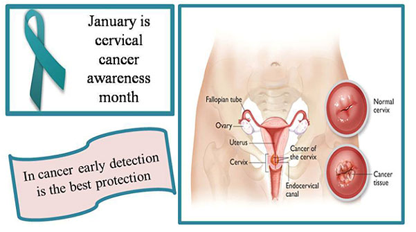 cervical-1
