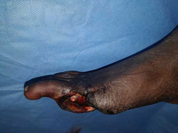 wounds-with-danger-signs