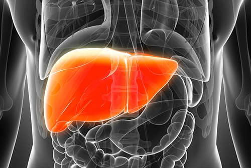 non-alcoholic-steato-hepatitis-nash-a-rising-scourge