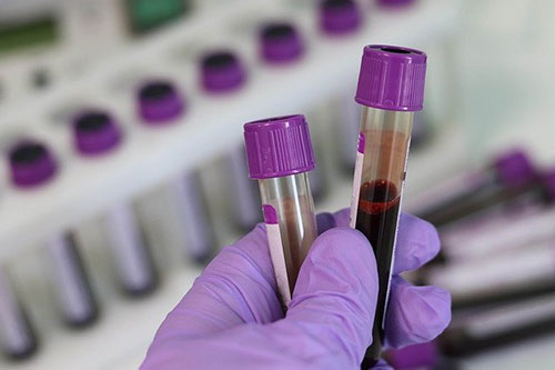your-blood-work-on-the-edge-of-normal