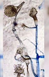 mucor-fungi