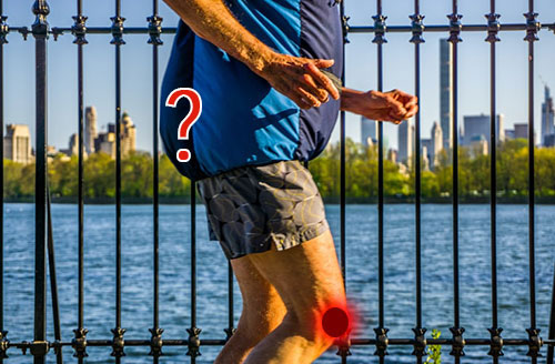 arthritis-of-the-knee-causing-low-back-pain-the-knee-spine-syndrome