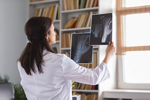 diabetes-mellitus-and-bone-health